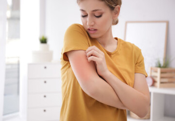 A woman with dry skin itching her arm.