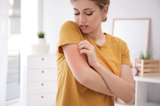 A woman with dry skin itching her arm.